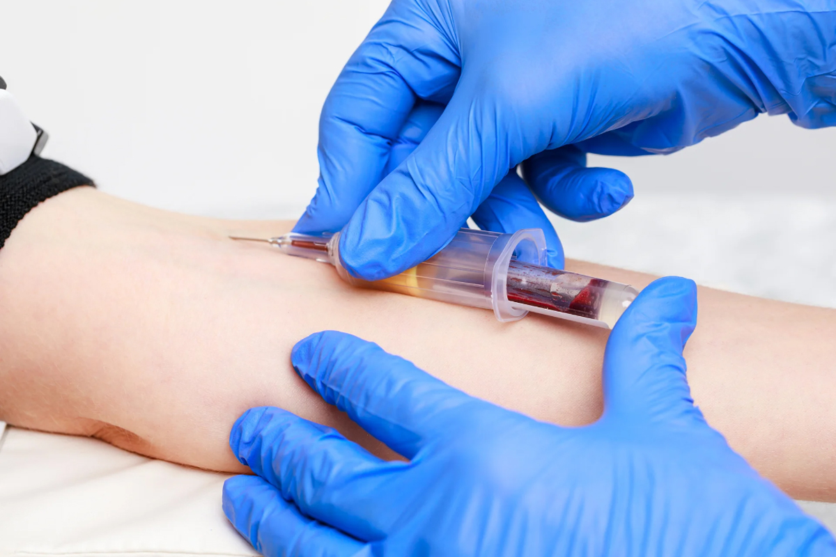 BLOOD GLUCOSE CHECK
